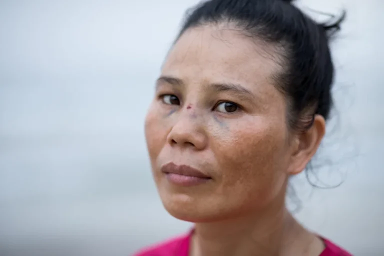 Helpless sad wounded woman after domestic violence,bruised woman looking at camera, assault in family